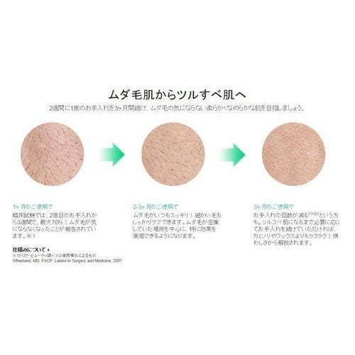 トリア(tria) 家庭用パーソナルレーザー脱毛器4X フーシャピンク